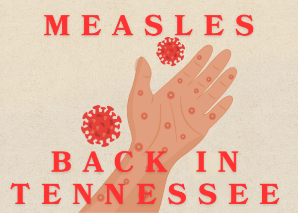 Measles Are Back in Nashville